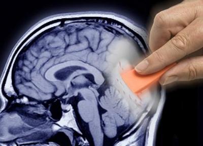 تغییر در شبکیه چشم بیماران مبتلا به آلزایمر ملایم
