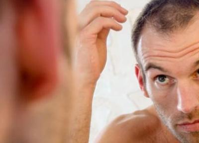 13 روش سریع و بی دردسر درمان ریزش موی مردان